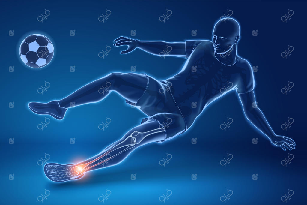 یک بازیکن فوتبال در حال اجرای ضربه کناری با مچ پای آسیب دیده، اثر اشعه ایکس به سبک سه‌بعدی