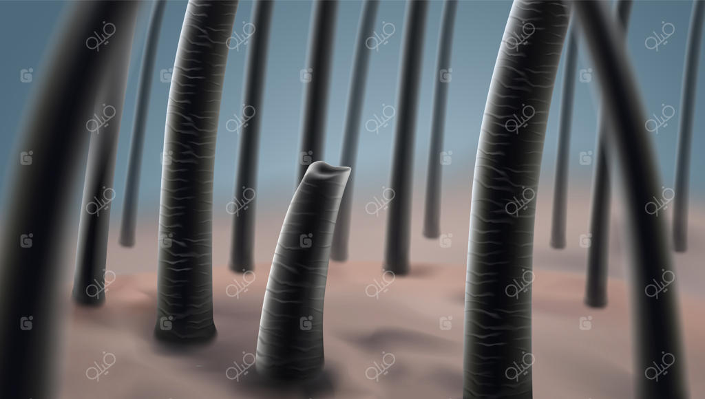 مشکلات ریزش مو، موخوره و کمبود ویتامین برای موها