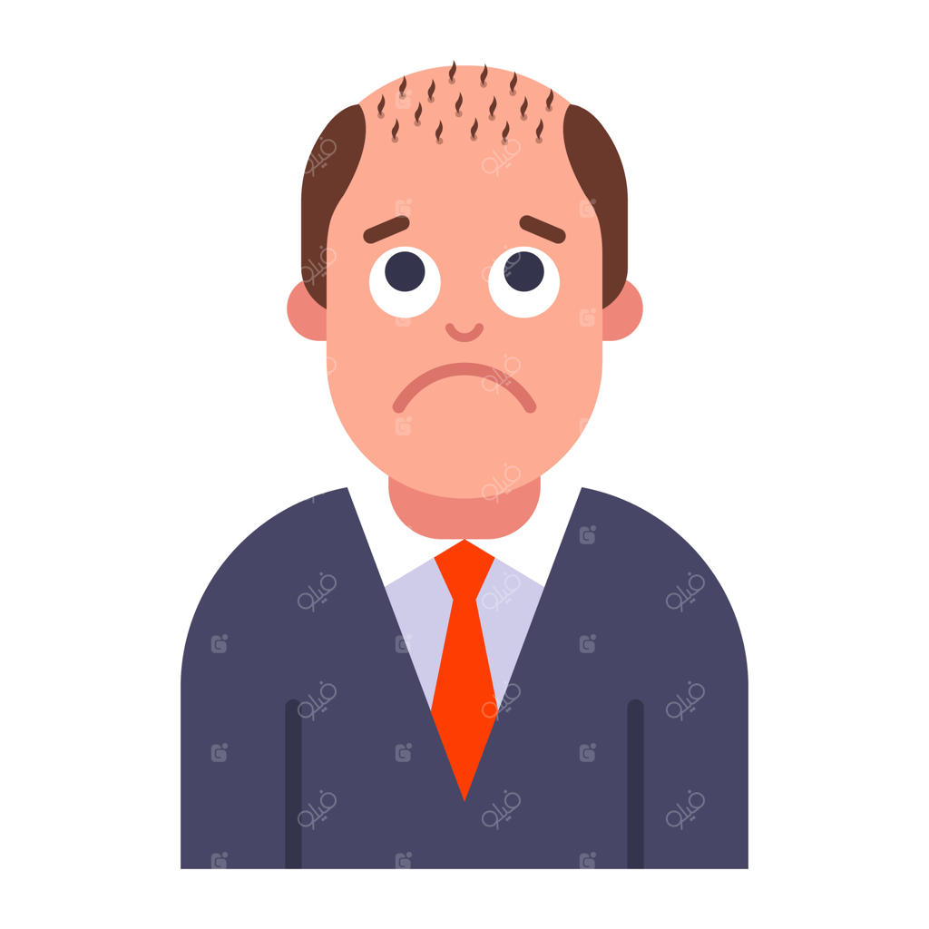 مشکل طاسی با الگوی مردانه و ریزش موی سر؛ تصویرسازی وکتور تخت