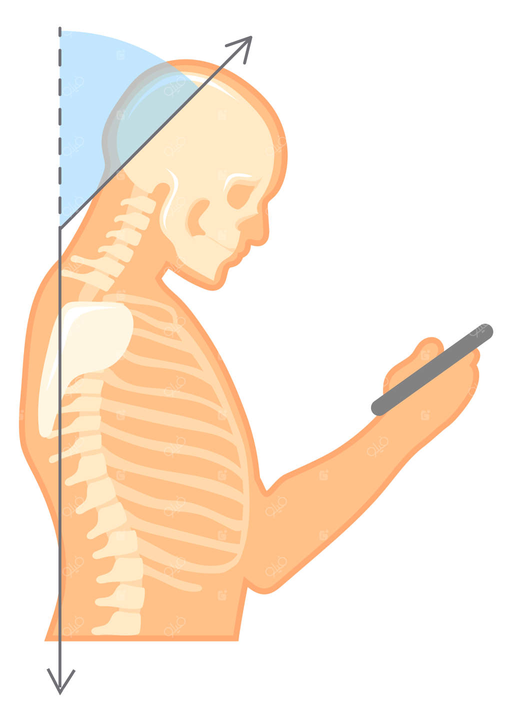 وضعیت گردن هنگام استفاده از گوشی هوشمند در حالت ایستاده