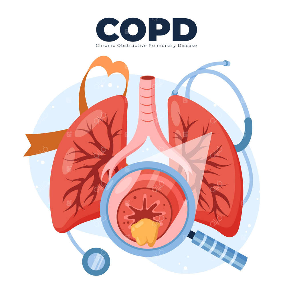 تصویر دستی و ساده بیماری COPD