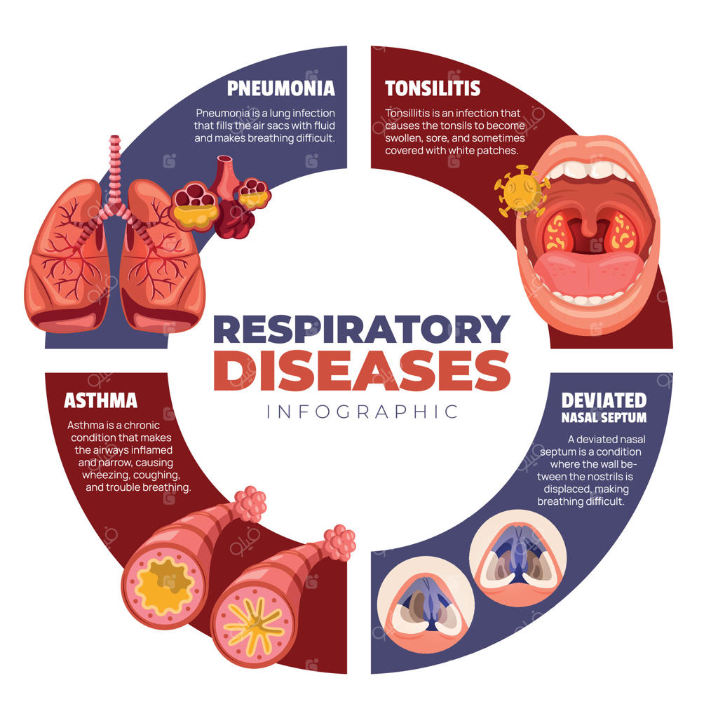 وکتور حرفه‌ای اینفوگرافیک تشریح بیماری‌های کلیدی تنفسی