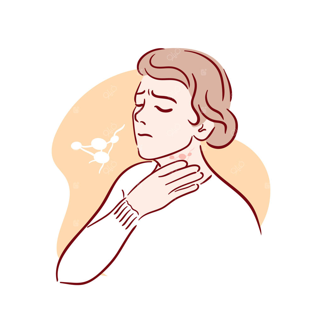 لنفادنیت. تورم غدد لنفاوی. زنی که دستش را روی گلوی دردناک خود گذاشته است. التهاب و درد. علائم آنفولانزا، لوسمی و توکسوپلاسموز. قالب بروشور پزشکی. تصویرسازی.