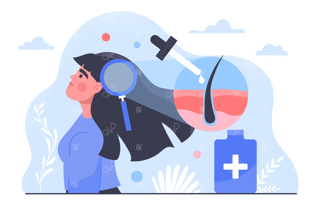 تصویرسازی وکتور فلت و کارتونی با مفهوم درمان ریزش مو؛ دختر جوان در کنار بطری آبی محلول دارویی برای مقابله با آلوپسی