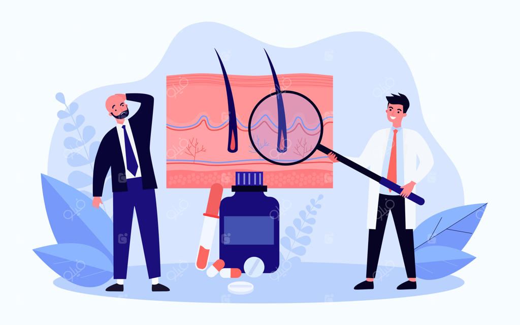 تصویرسازی وکتور فلت درمان ریزش مو. مرد طاس و پزشک با ذره‌بین بزرگ در حال بررسی ریشه‌های مو در کنار قرص‌های غول‌پیکر. کانسپت پزشکی، تریکولوژی و مراقبت از مو برای طراحی.