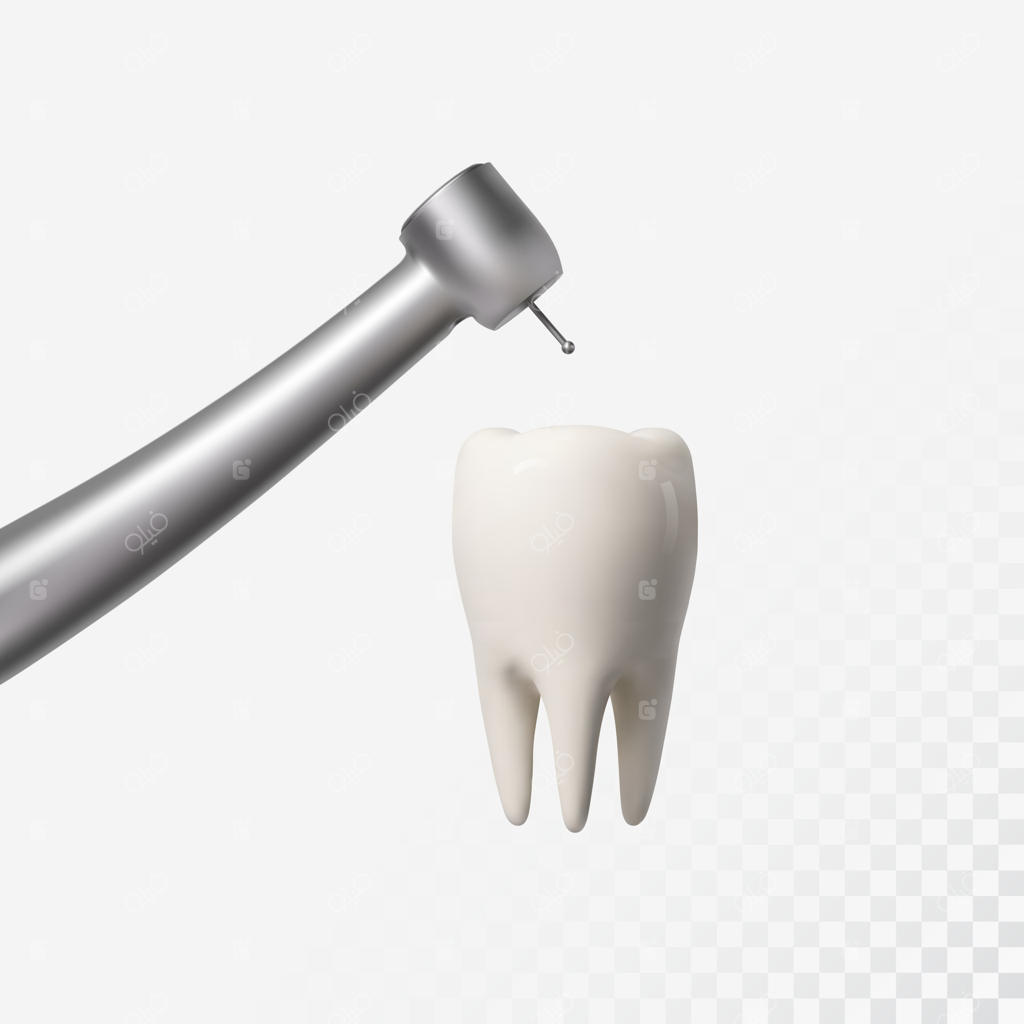 ایمپلنت دندان سفید: حفظ سلامت دندان یا جراحی دندانپزشکی؟
