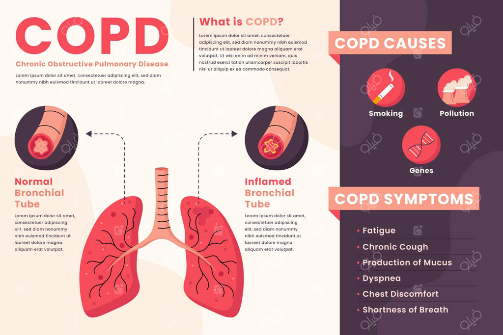 پترن اینفوگرافیک COPD با طراحی دستی و مسطح