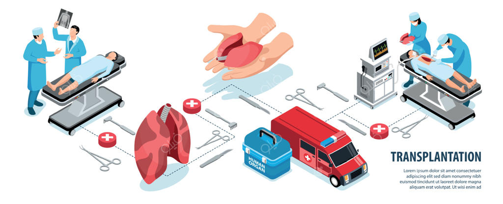 اینفوگرافیک ایزومتریک پیوند اعضا