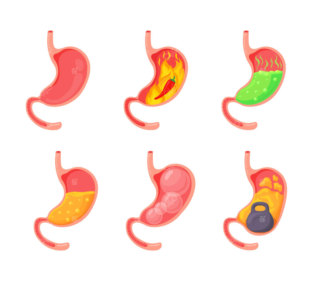 احساس سنگینی و درد در معده: نفخ، سوزش معده و ریفلاکس معده