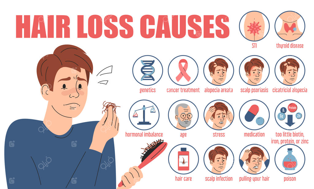 طرح وکتور و ایزوله بنر وب با موضوع اینفوگرافیکِ علل ریزش مو