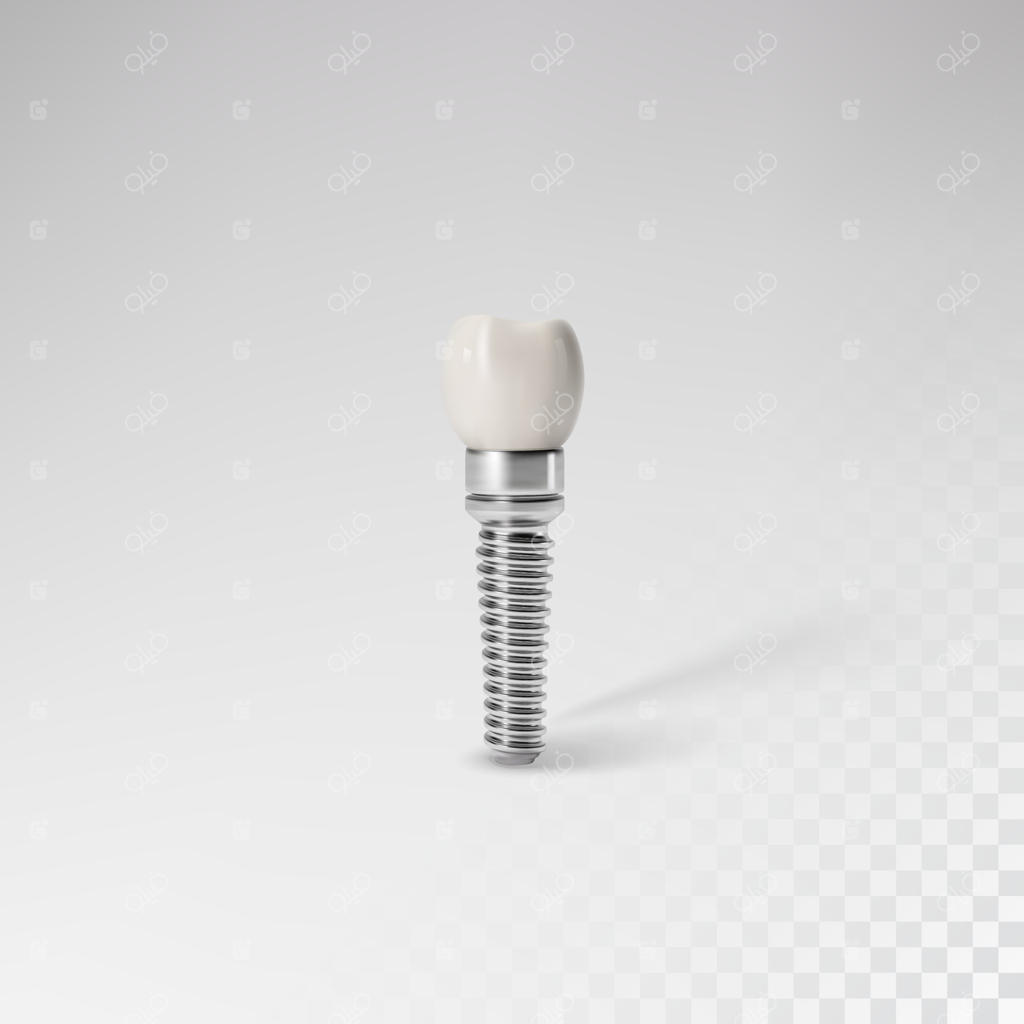 کاشت دندان سفید: پیوند دندان، دندان سالم یا جراحی دندان؟