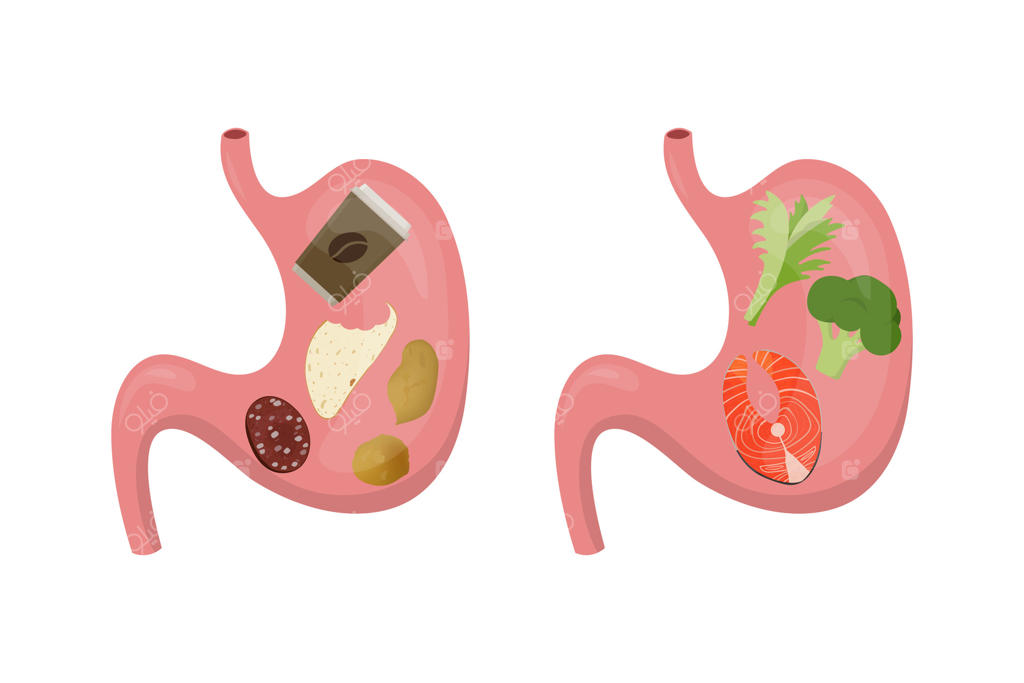 مقایسه تغذیه سالم و ناسالم برای معده و روده: نمایش سبزیجات، ماهی و چیپس، قهوه و سالامی در مفهوم مشکلات گوارشی