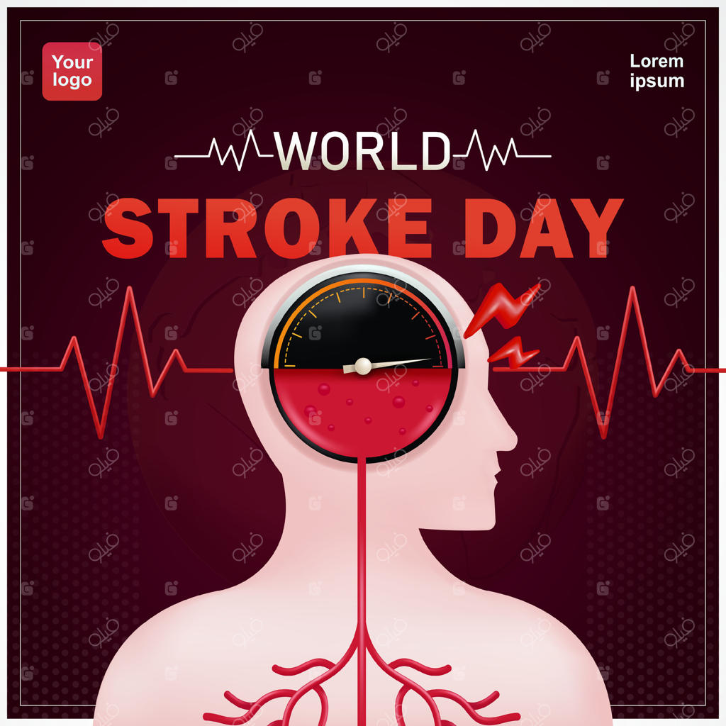 روز جهانی سکته مغزی: پارگی رگ خونی در مغز. سکته مغزی زمانی رخ می‌دهد که جریان خون به بخشی از مغز کاهش یابد یا متوقف شود. وکتور سه بعدی، مناسب برای امور سلامت، رویدادها و عناصر طراحی.
