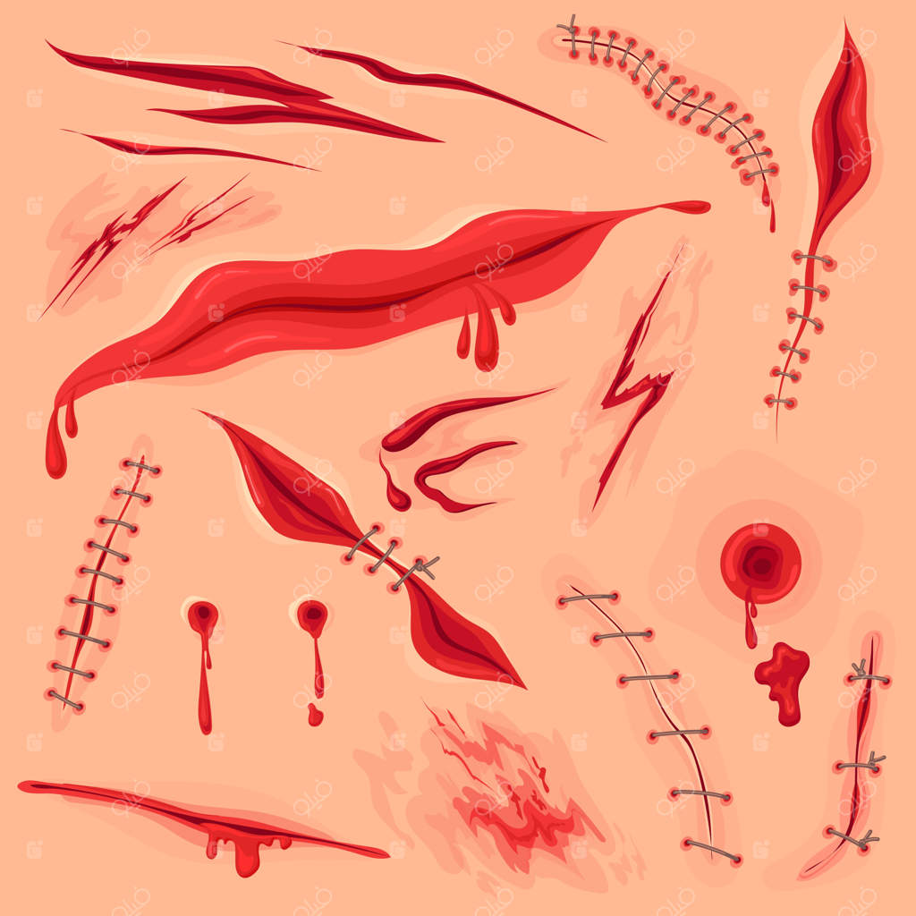 شکافت پوست: زخم خونین، بخیه جراحی یا بریدگی بدن، بافت آسیب‌دیده و زخمی، جای قرمز دردناک، ترسناک شبیه به هالووین