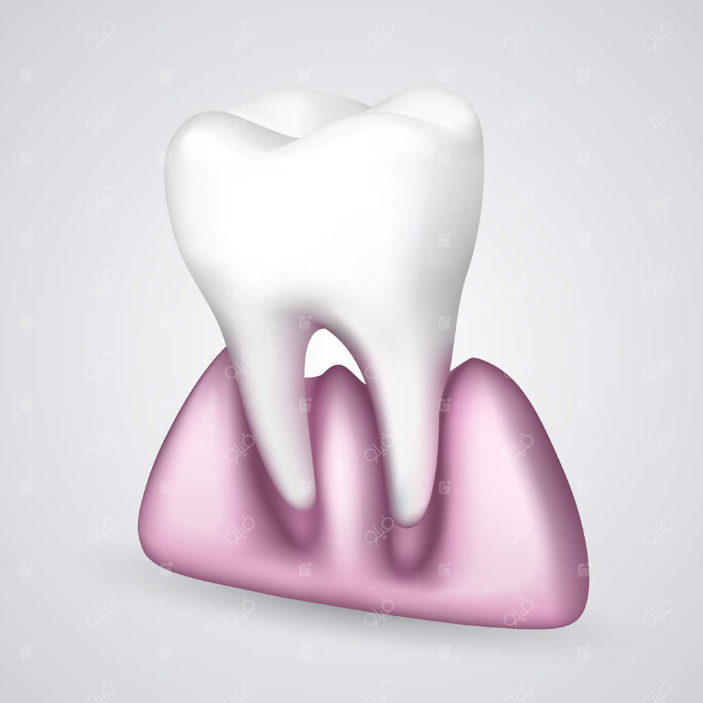 دندان وکتور از لثه افتاد