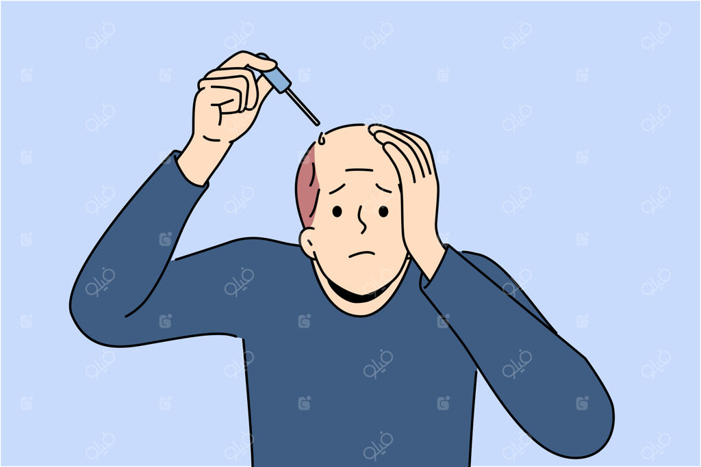 درمان طاسی سر مرد با روغن درمانی و قطره‌چکان برای بهبود رشد مو و افزایش جذابیت