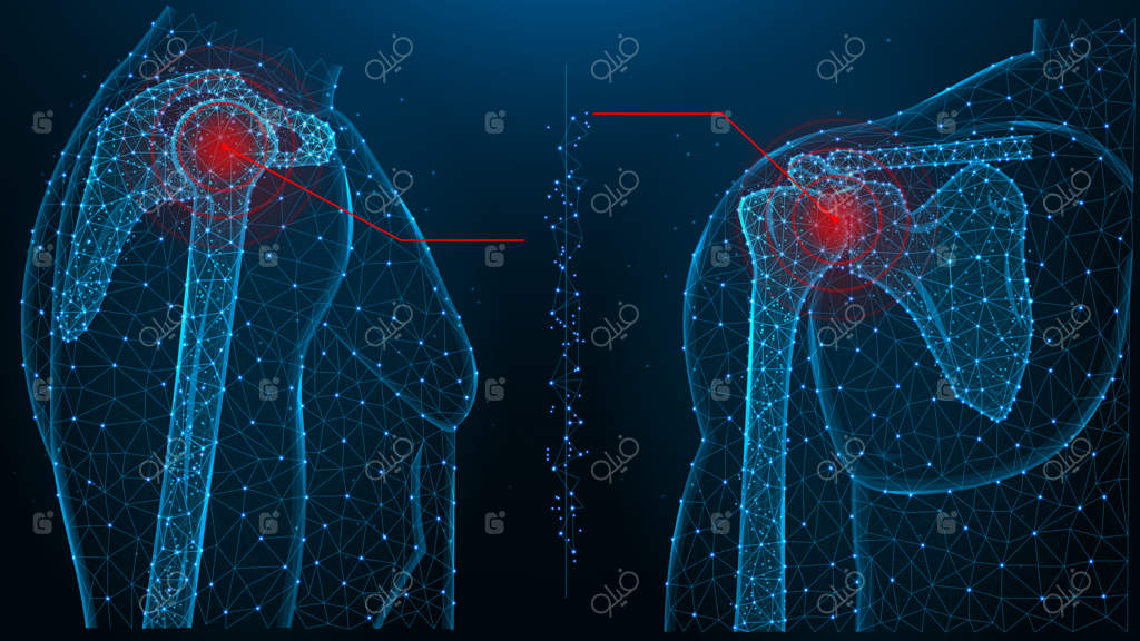 تصویر برداری چندضلعی آبی درد مفصل شانه